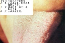 舌诊图片大全