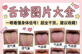舌诊图片大全